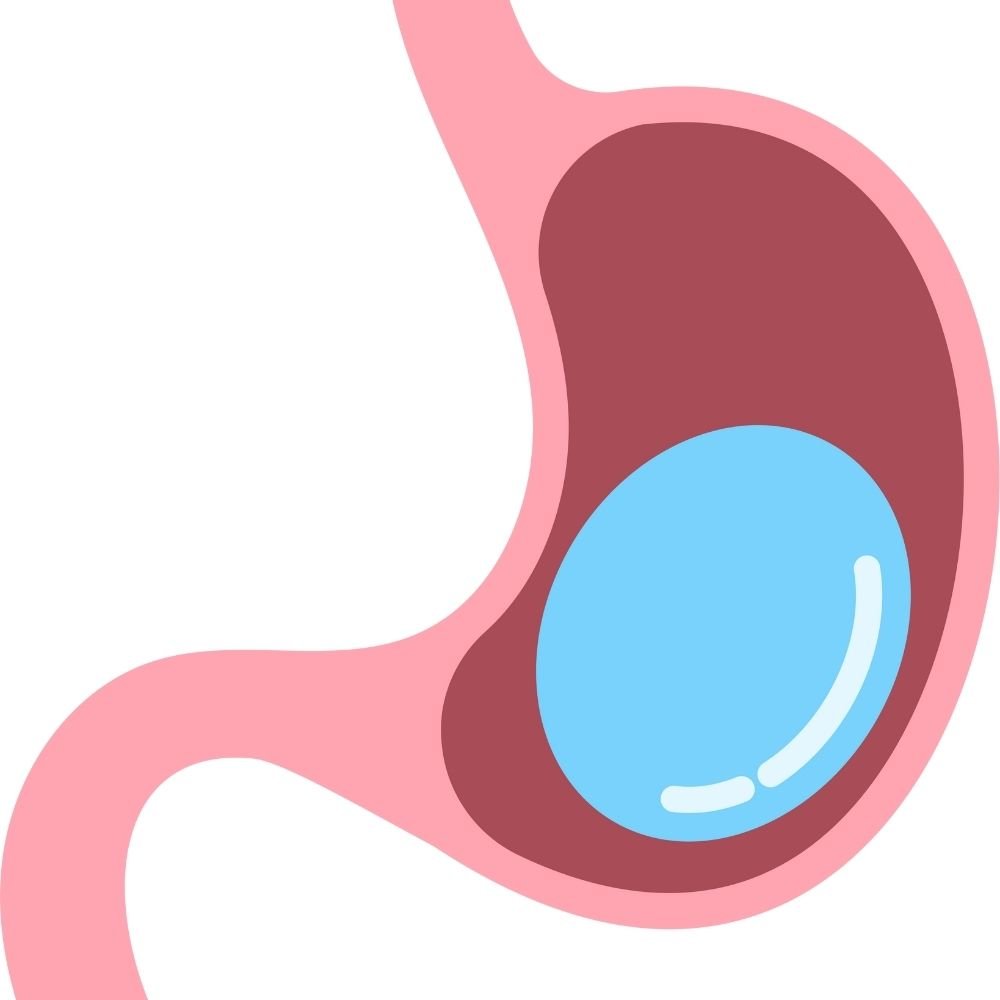Unlock Your Weight Loss Potential with Gastric Balloon Surgery in Turkey