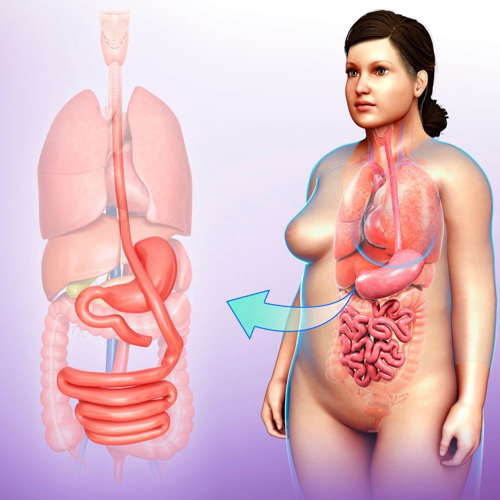 Transform Your Life with Mini Gastric Bypass in Turkey