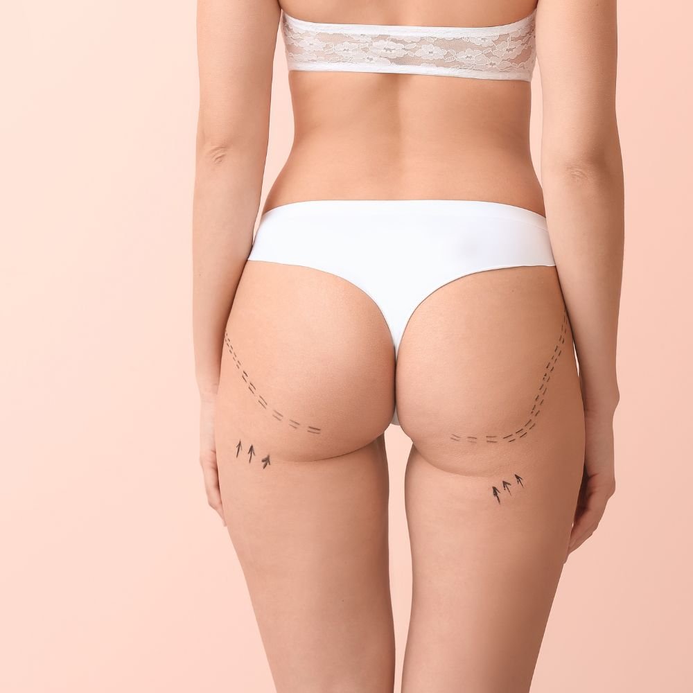 Revisional Surgeries