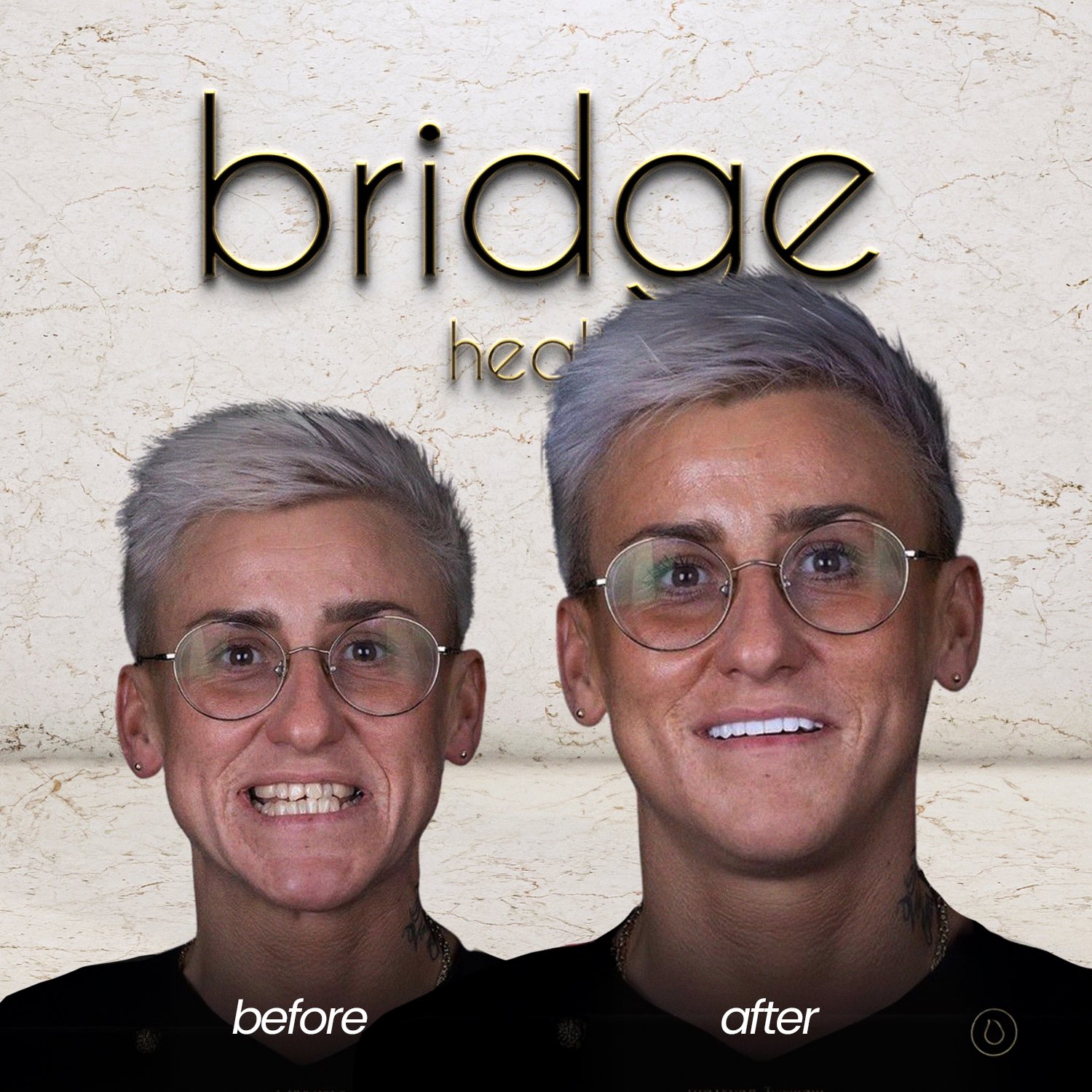 before after 1