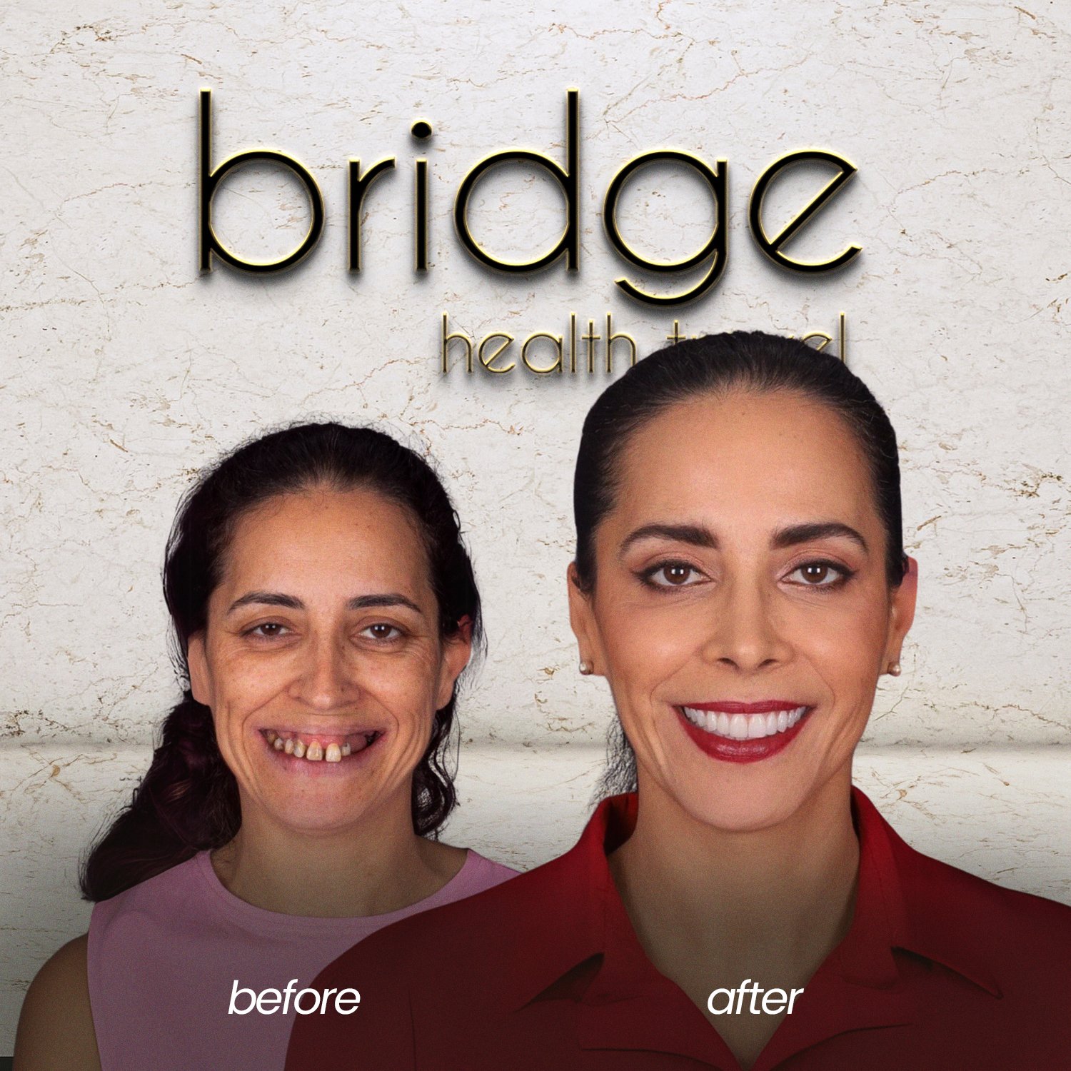 before after 10