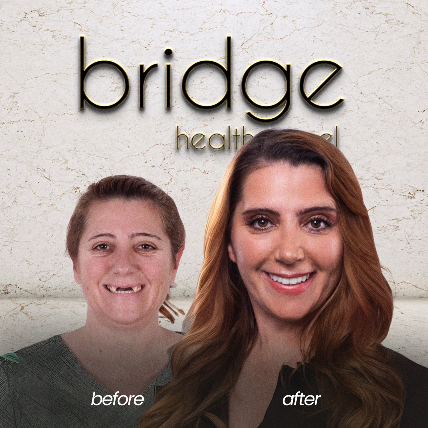 before after 13