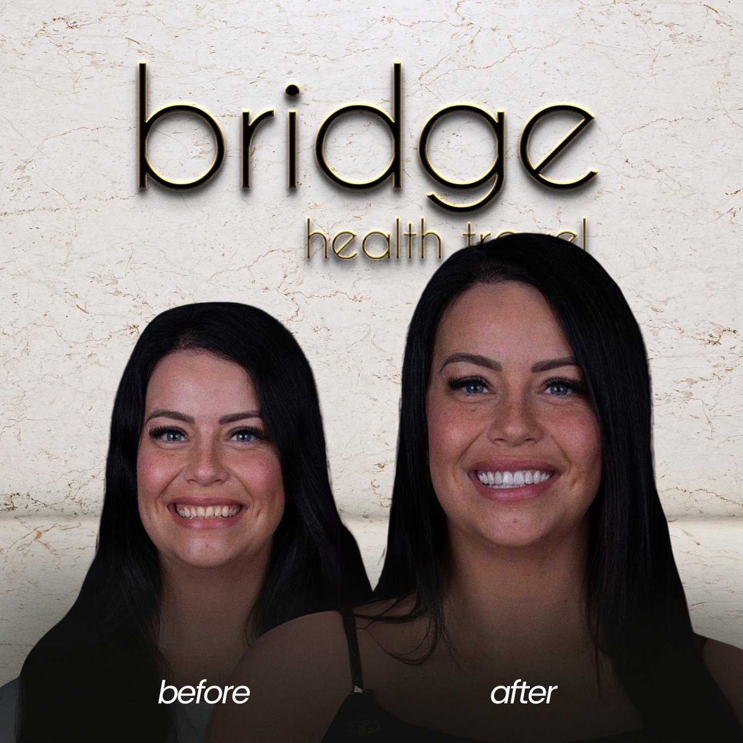 before after 5