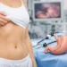 Guide to Scarless Gastric Sleeve Surgery