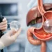 How Gastric Balloon Placement Works Step by Step